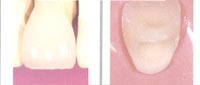 crown-spsmile-f