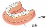 全ての歯を失った場合