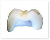 inlay-crown-se